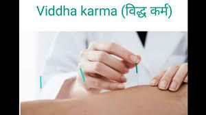 Viddha Karma